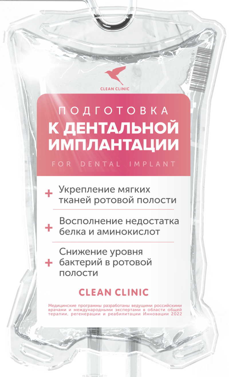 Дентальная имплантация ДО